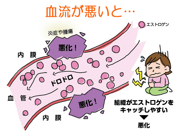 血流1