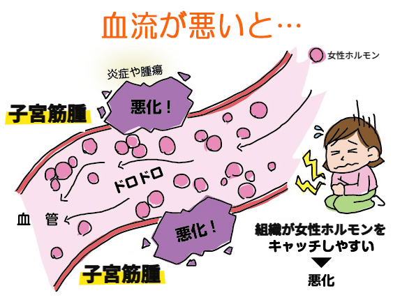 血流1